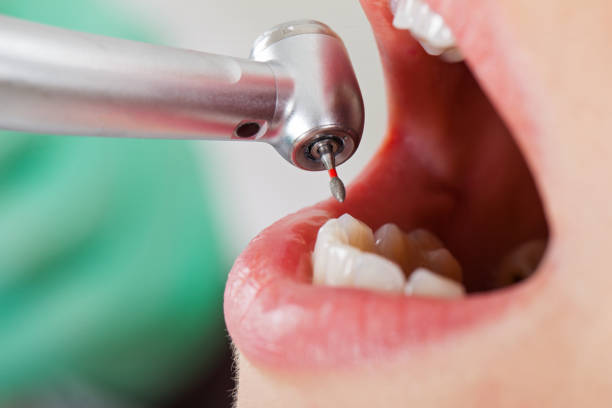 Best Emergency Dental Surgery in Essexville, MI